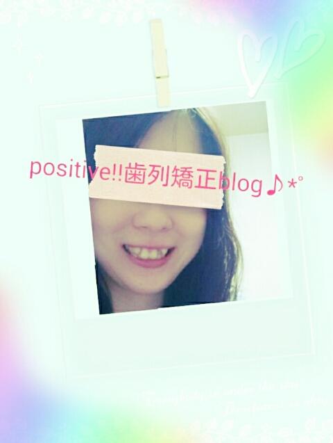 抜歯 右上２番 左上２番 Positive 歯列矯正blog