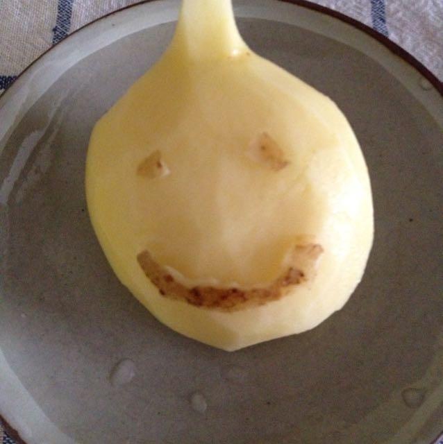 帝王切開のこと 杏の日記
