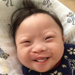 口唇口蓋裂でダウン症 ダウン症で口唇口蓋裂のしんちゃんのブログ 口唇口蓋裂でダウン症 ダウン症で口唇口蓋裂のしんちゃんのブログ
