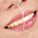 自宅で出来る歯のホワイトニングの通販社長のブログ