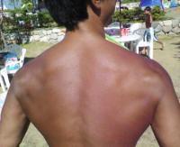 show
