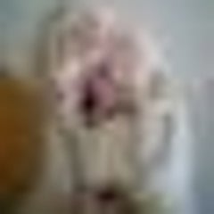 std 尖圭コンジローマ うづブロo std 尖圭コンジローマ うづブロo