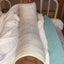 足首粉砕骨折　初の骨折、手術、リハビリ、からの偽関節手術、骨移植手術のサムネイル