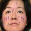 山崎  美穂 ｜「日にち薬」では治らない大人のための鍼灸院｜はりきゅう和-nagomi-のサムネイル