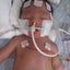 画像 14分間の心肺停止から息を吹き返した奇跡の子ミツキのお話のユーザープロフィール画像