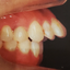 画像 40歳からの歯列矯正～超出っ歯から綺麗な歯並びへの道～のユーザープロフィール画像
