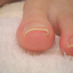 巻き爪矯正ブログ〜スタート整体院〜のプロフィール