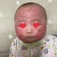 画像 娘の乳児湿疹と闘った　あとぴっこママ　〜産まれた娘は重症アトピーになりました〜のユーザープロフィール画像