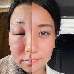 すきくら/3ヶ月で重度アトピー脱却のプロフィール