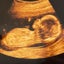 画像 maminaの妊娠&育児日記のユーザープロフィール画像