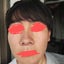 画像 脂漏性皮膚炎のINFP男のユーザープロフィール画像